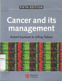 Cancer And its Management