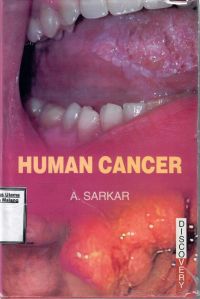 Human Cancer 