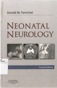Neonatal Neurology 